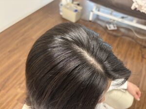 理想的な頭皮って！